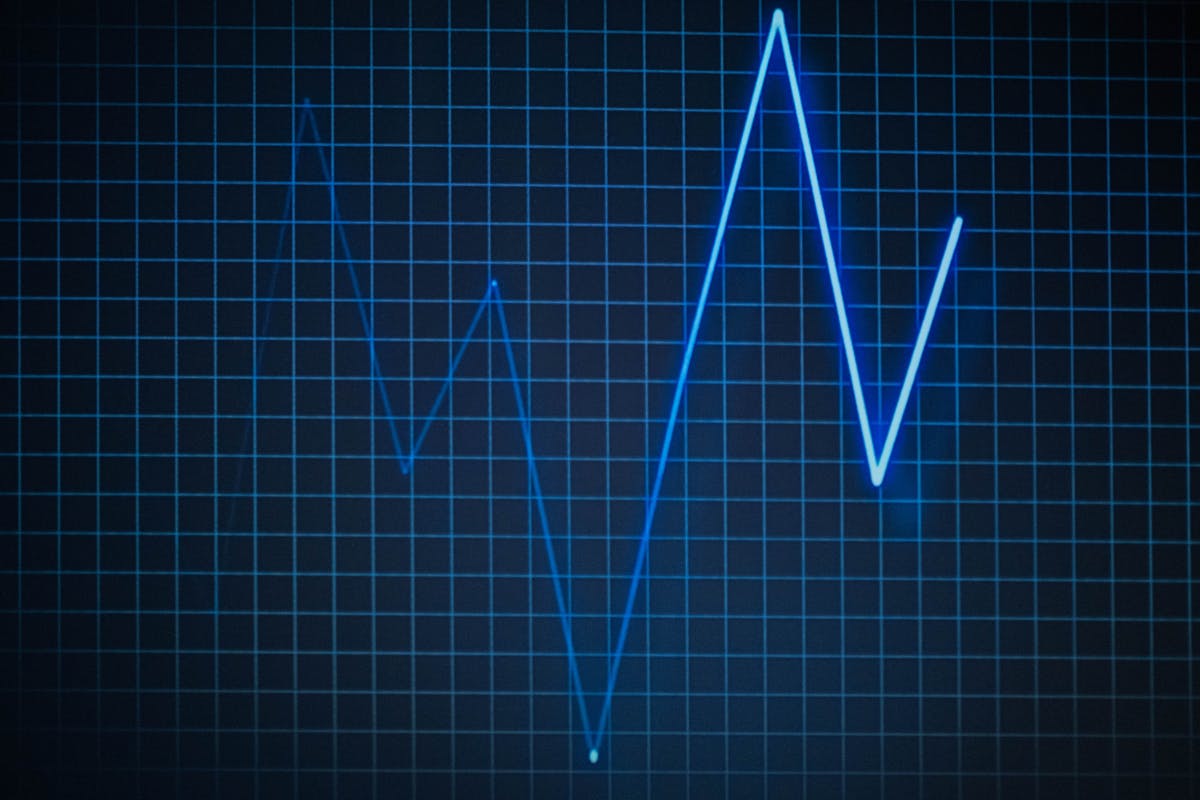 Rate Blue heartbeat line graph on a dark grid background, displaying peaks and troughs indicative of heart rate variability