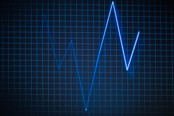 Rate Blue heartbeat line graph on a dark grid background, displaying peaks and troughs indicative of heart rate variability