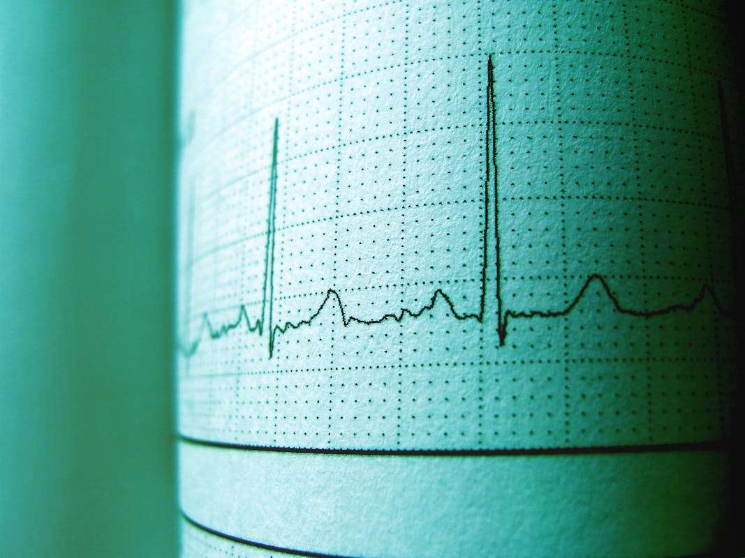 Close-up of a heart rate variability (HRV) graph on medical paper, displaying peaks and troughs indicative of heartbeat intervals.